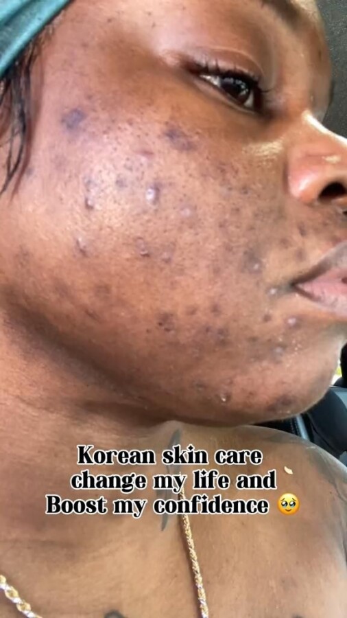 soins visage bienfaits peau