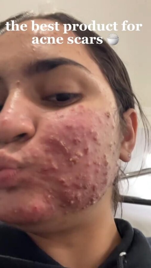 soins visage bienfaits peau